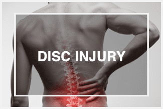 Chiropractic Roswell GA Disc Injury