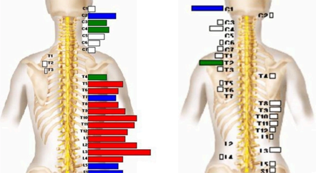 A spine diagram highlights different vertebrae and nerve areas with color coding.